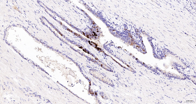 SERPINB3 Antibody in Immunohistochemistry (Paraffin) (IHC (P))