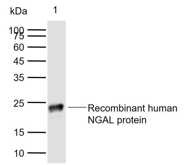 NGAL Antibody in Western Blot (WB)