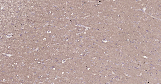 CD90 Antibody in Immunohistochemistry (Paraffin) (IHC (P))