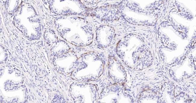 NGFR Antibody in Immunohistochemistry (Paraffin) (IHC (P))
