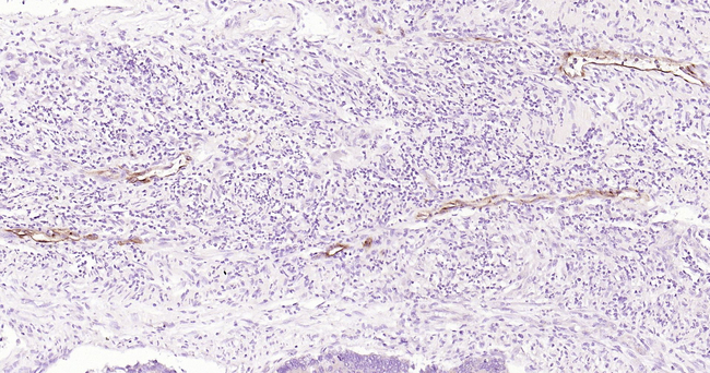E-selectin Antibody in Immunohistochemistry (Paraffin) (IHC (P))