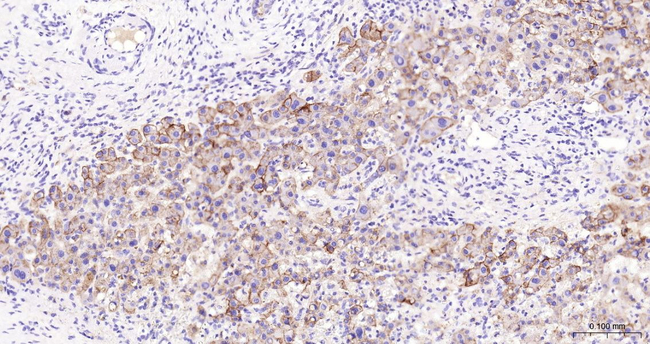 CD138 Antibody in Immunohistochemistry (Paraffin) (IHC (P))