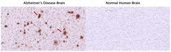 Amyloid beta 42 Antibody in Immunohistochemistry (Paraffin) (IHC (P))