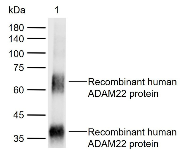 ADAM22 Antibody in Western Blot (WB)