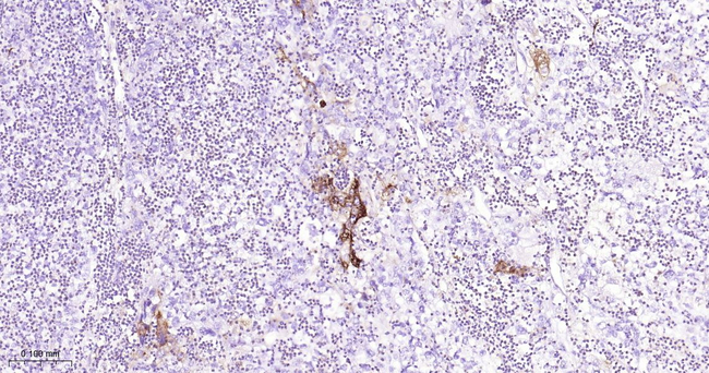 HLA-DRA Antibody in Immunohistochemistry (Paraffin) (IHC (P))
