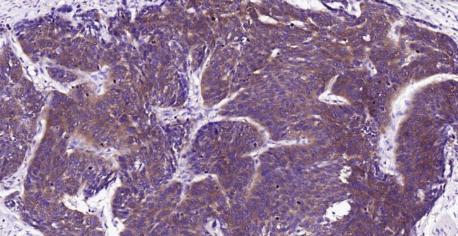 FASN Antibody in Immunohistochemistry (Paraffin) (IHC (P))