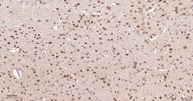 PIN1 Antibody in Immunohistochemistry (Paraffin) (IHC (P))