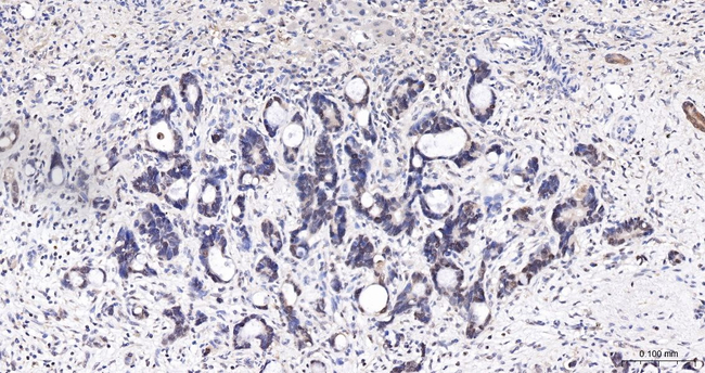 PGK1 Antibody in Immunohistochemistry (Paraffin) (IHC (P))