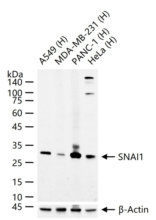 SNAIL Antibody in Western Blot (WB)