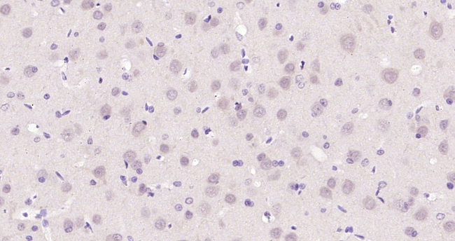 EZH2 Antibody in Immunohistochemistry (Paraffin) (IHC (P))