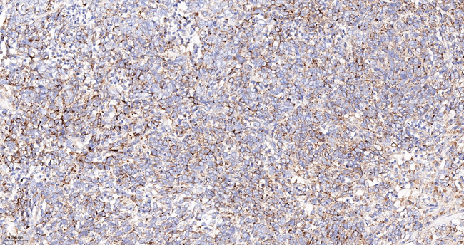 LAMP2 Antibody in Immunohistochemistry (Paraffin) (IHC (P))