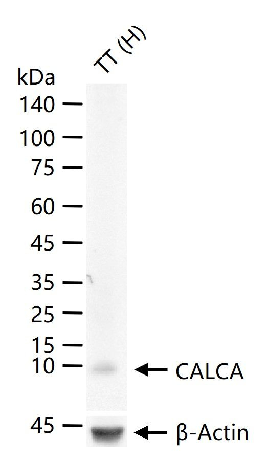Calcitonin Antibody in Western Blot (WB)