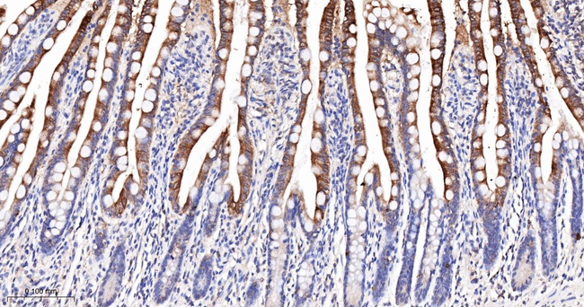 CYP3A4 Antibody in Immunohistochemistry (Paraffin) (IHC (P))