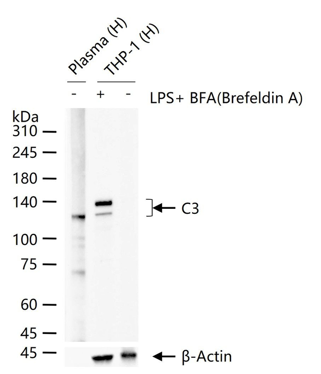 Complement C3 Antibody in Western Blot (WB)