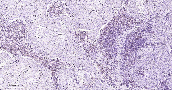 BCL-10 Antibody in Immunohistochemistry (Paraffin) (IHC (P))