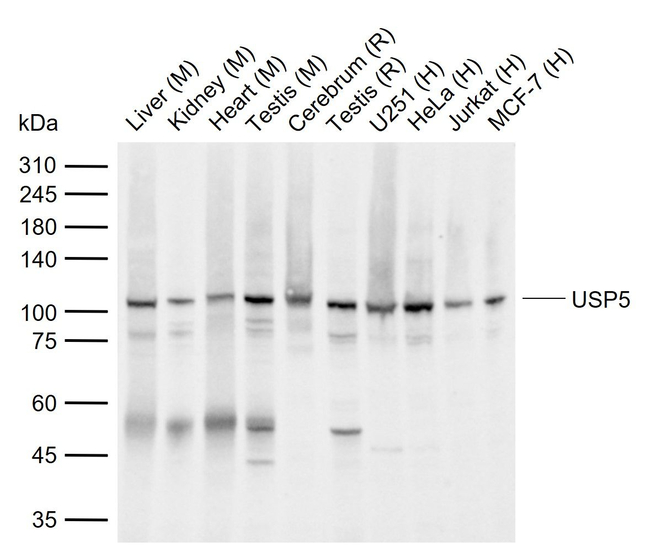 USP5 Antibody in Western Blot (WB)