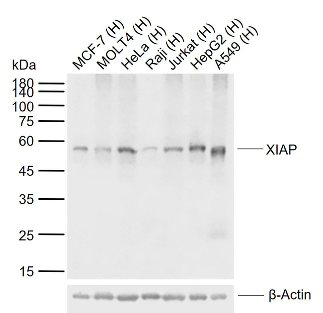 XIAP Antibody in Western Blot (WB)