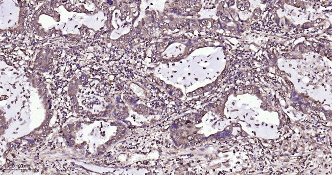 Aurora A Antibody in Immunohistochemistry (Paraffin) (IHC (P))