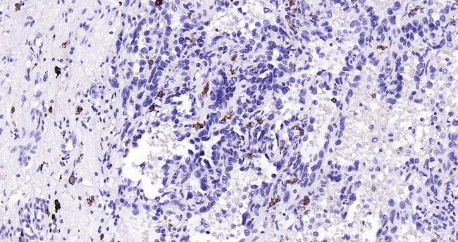 c-Kit Antibody in Immunohistochemistry (Paraffin) (IHC (P))