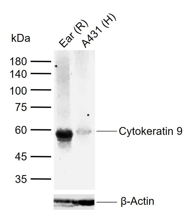 KRT9 Antibody in Western Blot (WB)