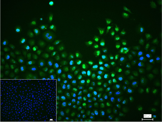 FosB Antibody in Immunocytochemistry (ICC/IF)