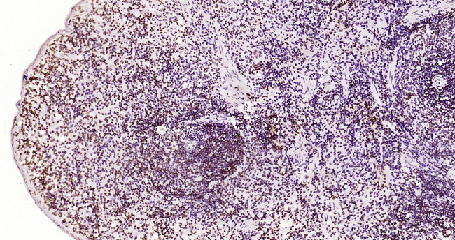 Phospho-JAK2 (Tyr1007, Tyr1008) Antibody in Immunohistochemistry (Paraffin) (IHC (P))