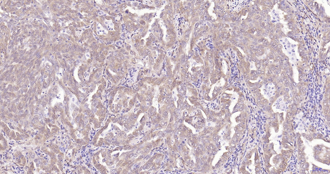 Phospho-YAP1 (Ser127) Antibody in Immunohistochemistry (Paraffin) (IHC (P))