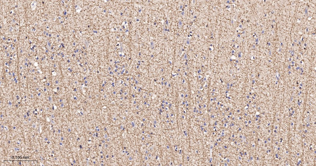SIRT2 Antibody in Immunohistochemistry (Paraffin) (IHC (P))