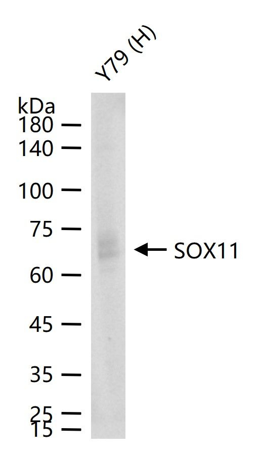 SOX11 Antibody in Western Blot (WB)