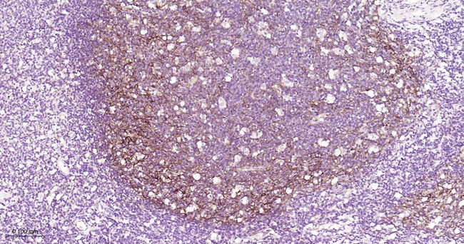 VCAM-1 Antibody in Immunohistochemistry (Paraffin) (IHC (P))