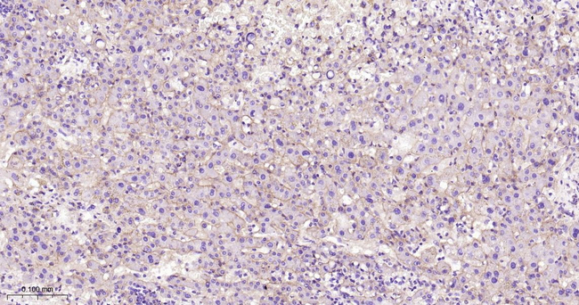 CD29 Antibody in Immunohistochemistry (Paraffin) (IHC (P))