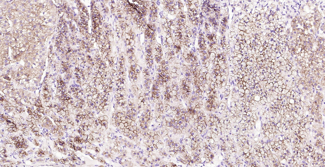 SR-BI Antibody in Immunohistochemistry (Paraffin) (IHC (P))