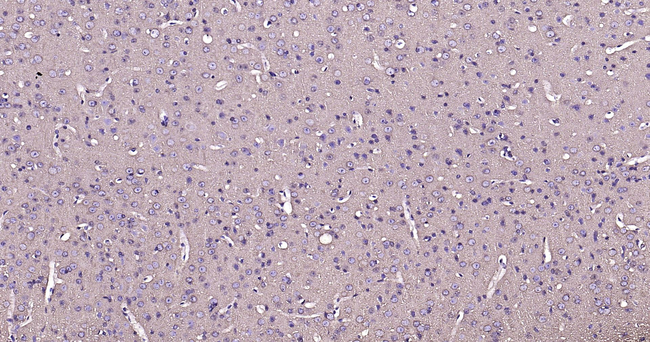 beta Tubulin Antibody in Immunohistochemistry (Paraffin) (IHC (P))