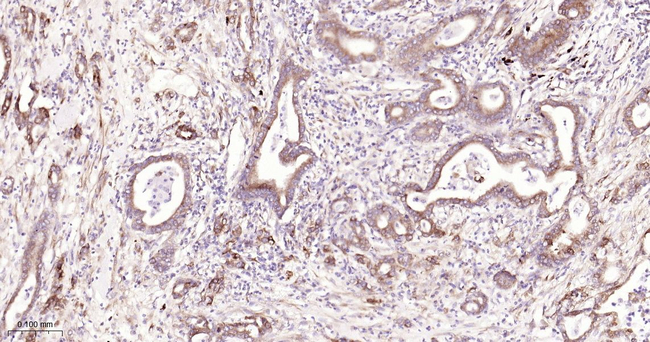 Phospho-EIF2A (Ser51) Antibody in Immunohistochemistry (Paraffin) (IHC (P))