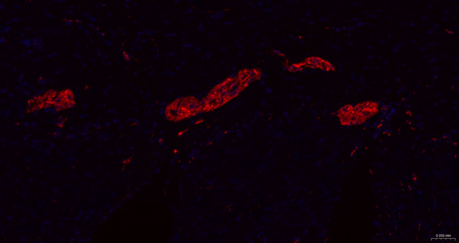 Tau Antibody in Immunohistochemistry (Paraffin) (IHC (P))