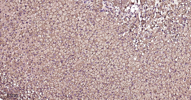 LDLR Antibody in Immunohistochemistry (Paraffin) (IHC (P))