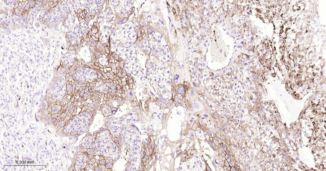 CD61 Antibody in Immunohistochemistry (Paraffin) (IHC (P))