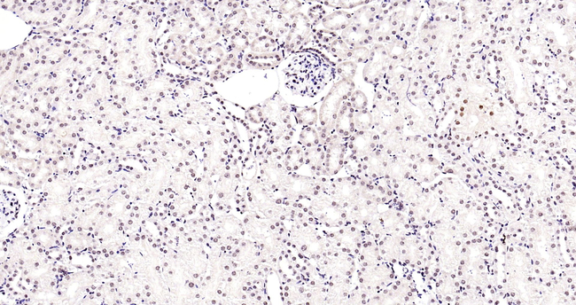 NOX4 Antibody in Immunohistochemistry (Paraffin) (IHC (P))