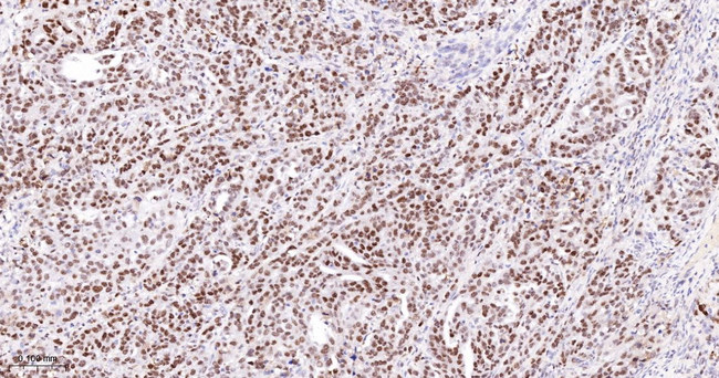 PARP1 (cleaved Asp214) Antibody in Immunohistochemistry (Paraffin) (IHC (P))
