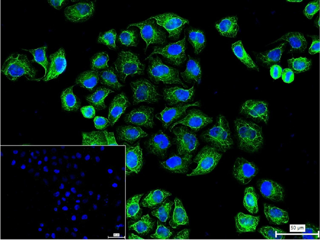 Cytokeratin 8 Antibody in Immunocytochemistry (ICC/IF)