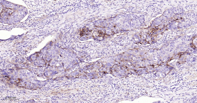 5T4 Antibody in Immunohistochemistry (Paraffin) (IHC (P))