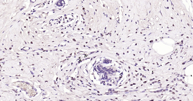 PARP1 Antibody in Immunohistochemistry (Paraffin) (IHC (P))
