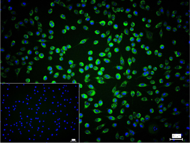Calreticulin Antibody in Immunocytochemistry (ICC/IF)