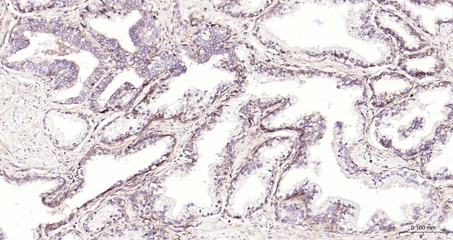 RAB5 Antibody in Immunohistochemistry (Paraffin) (IHC (P))