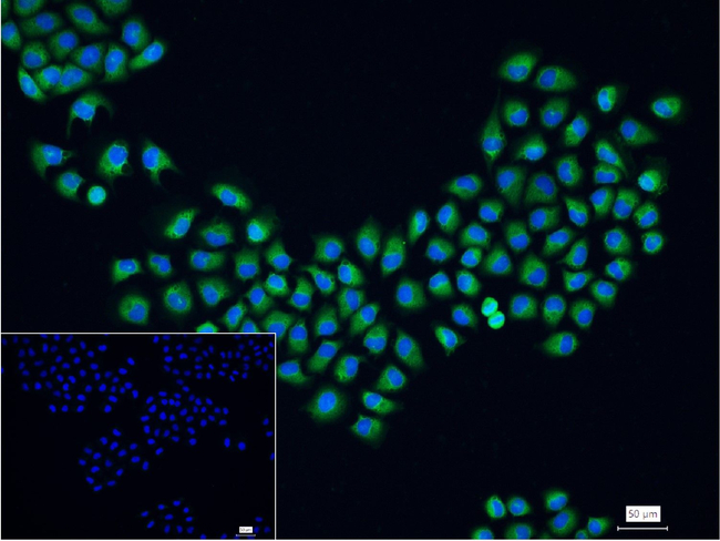 ATP Citrate Lyase Antibody in Immunocytochemistry (ICC/IF)