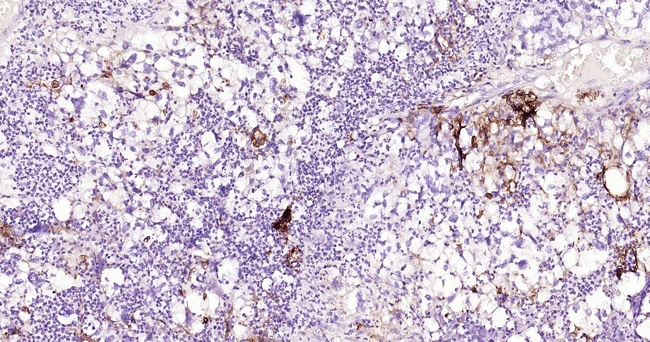 ICAM-1 Antibody in Immunohistochemistry (Paraffin) (IHC (P))