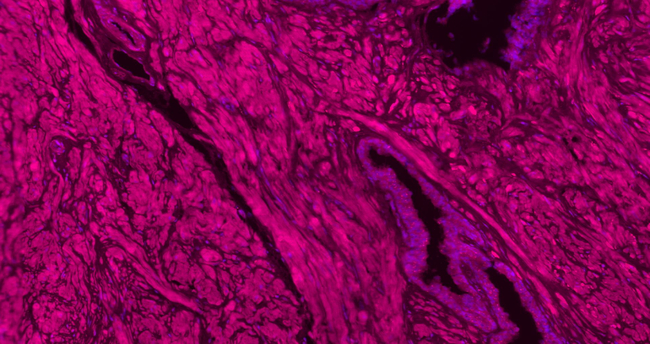 Collagen I Antibody in Immunohistochemistry (Paraffin) (IHC (P))