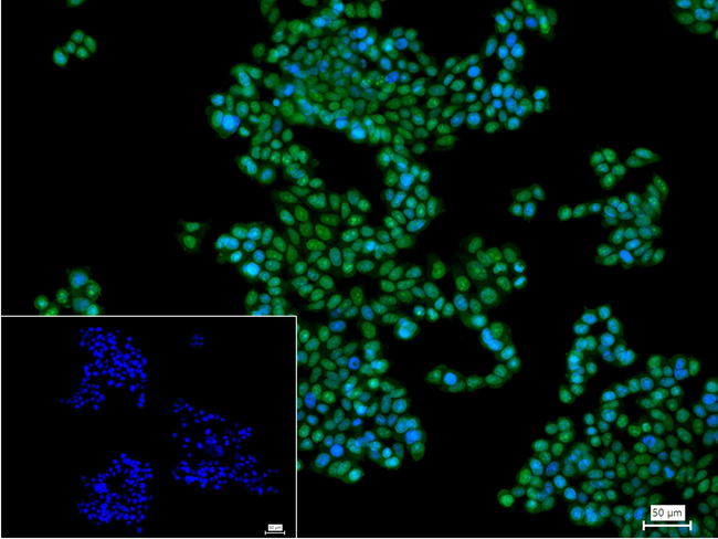 TOP1 Antibody in Immunocytochemistry (ICC/IF)
