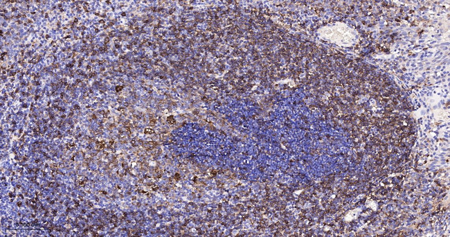 HLA-DR Antibody in Immunohistochemistry (Paraffin) (IHC (P))