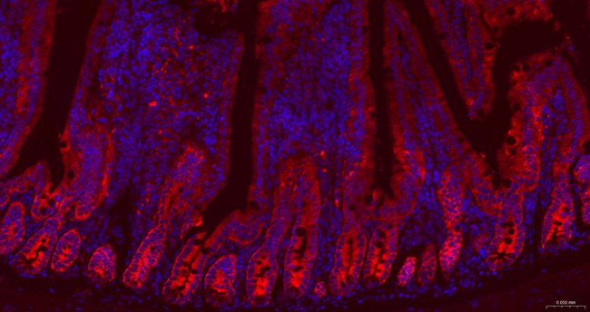 GART Antibody in Immunohistochemistry (Paraffin) (IHC (P))